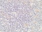 Endoglin Polyclonal Antibody
